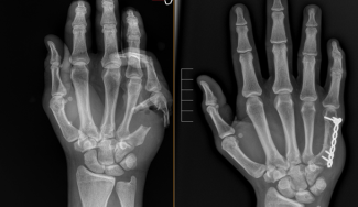 Hand Fellowship Image 0