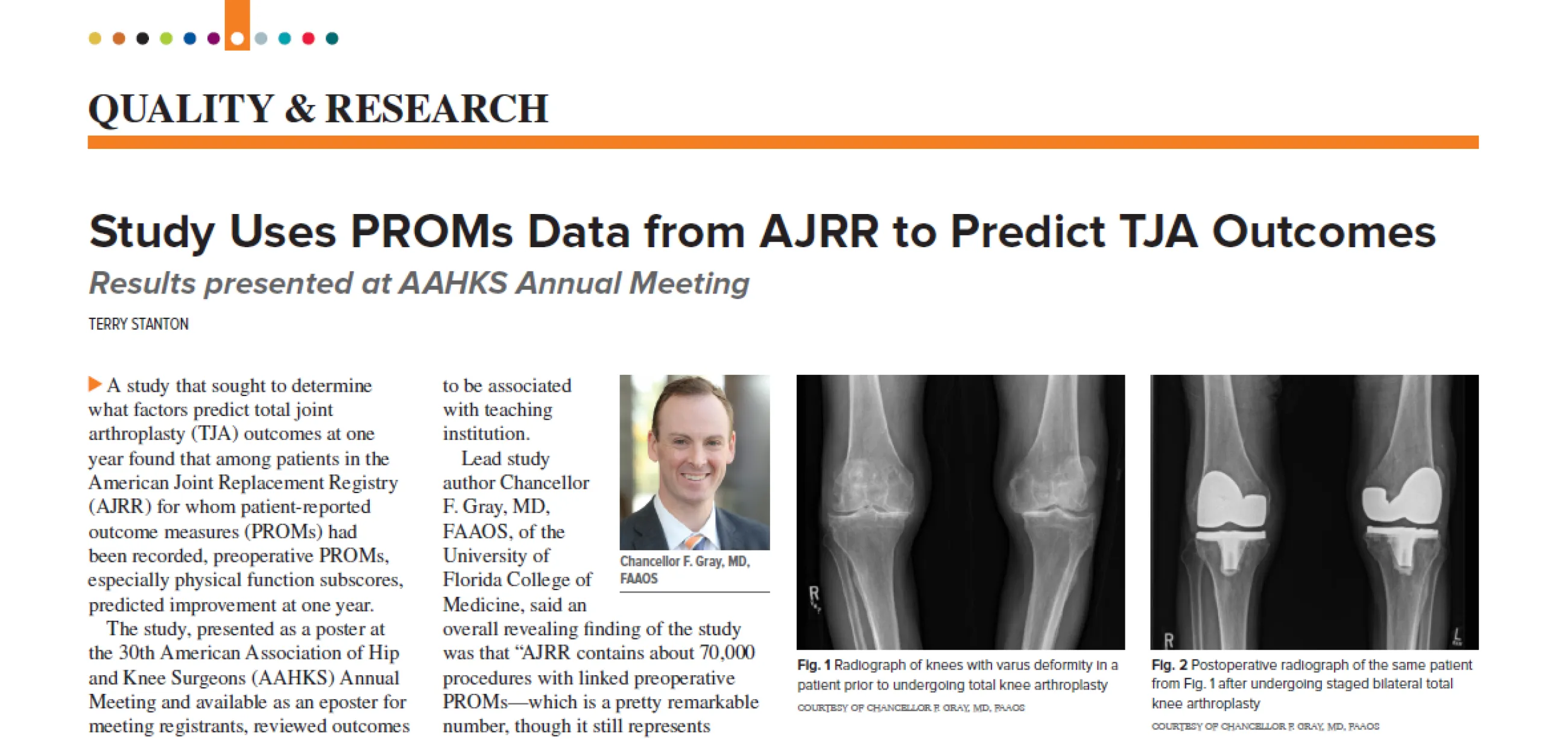UF Ortho Featured in AAOS Now: Study Uses PROMs Data from AJRR to Predict TJA Outcomes