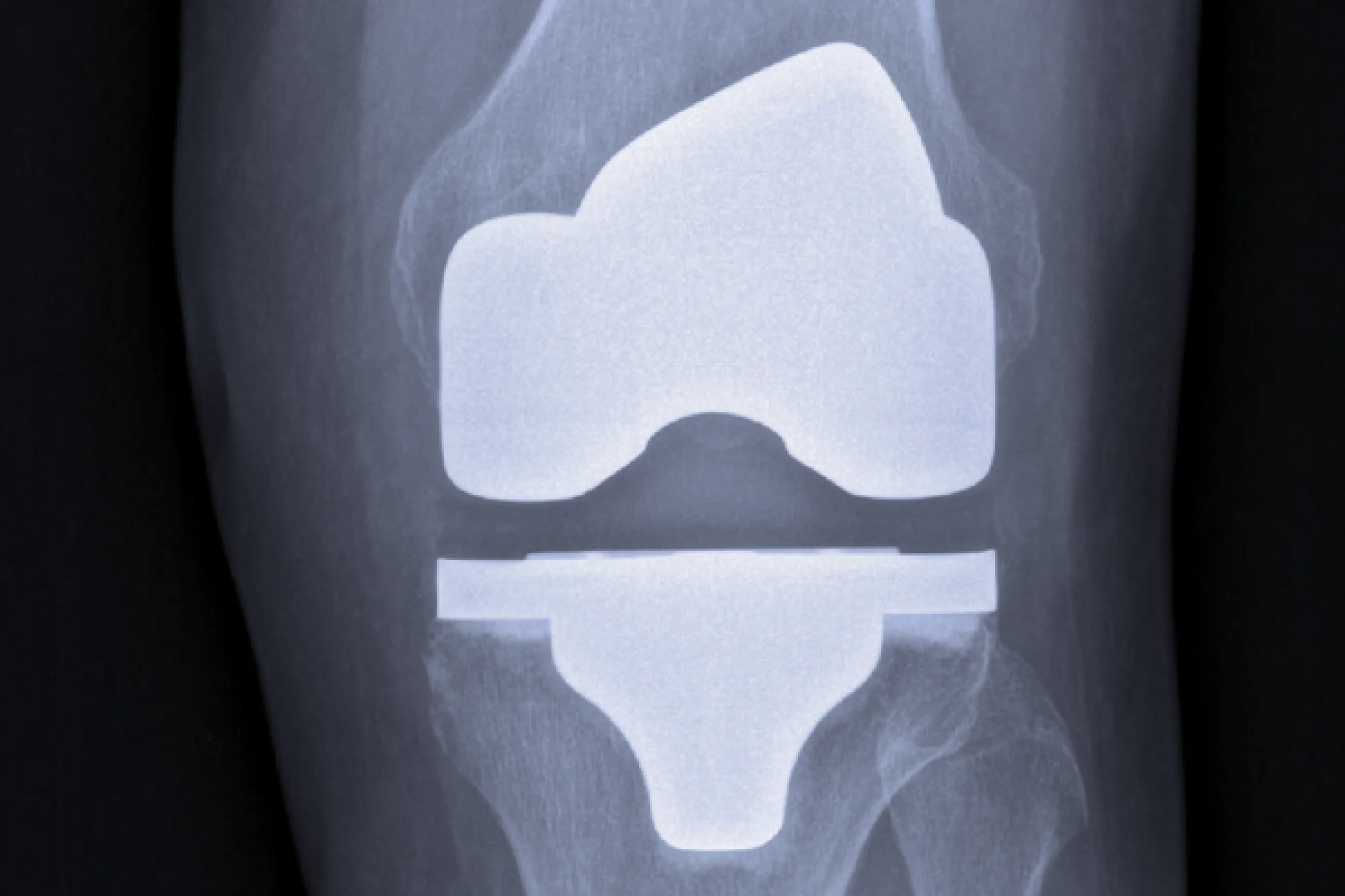 Ortho Job: Joints Surgeon 01