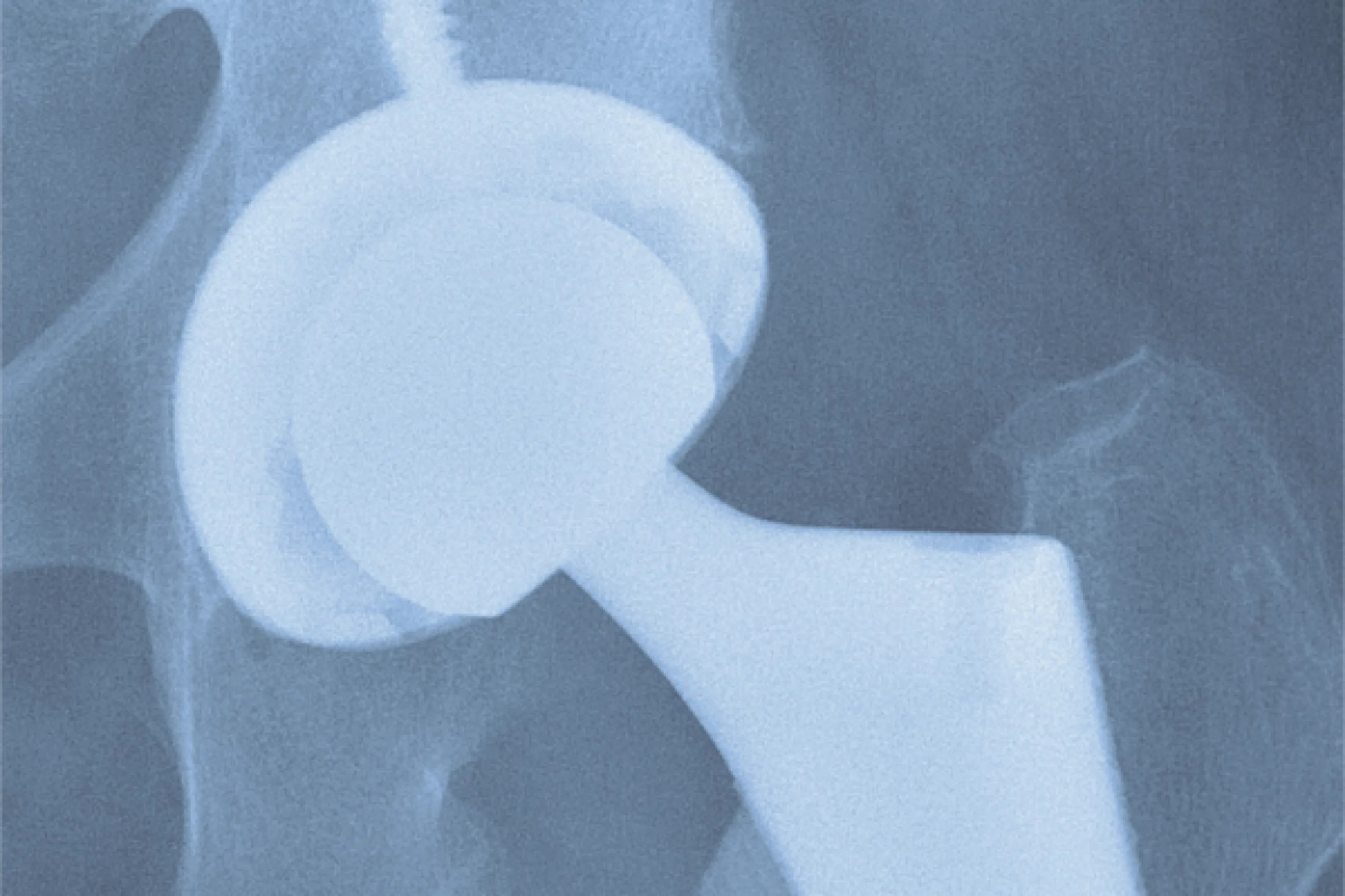 Ortho Job: Joints Surgeon 02