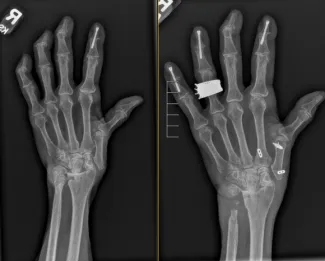 Hand Fellowship Image 01