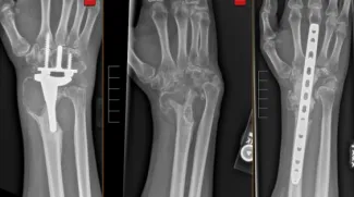 Hand Fellowship Image 04