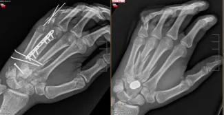 Hand Fellowship Image 09
