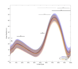 Biomechanical Analysis of Gait in a Walking Boot Study Results - Figure 2